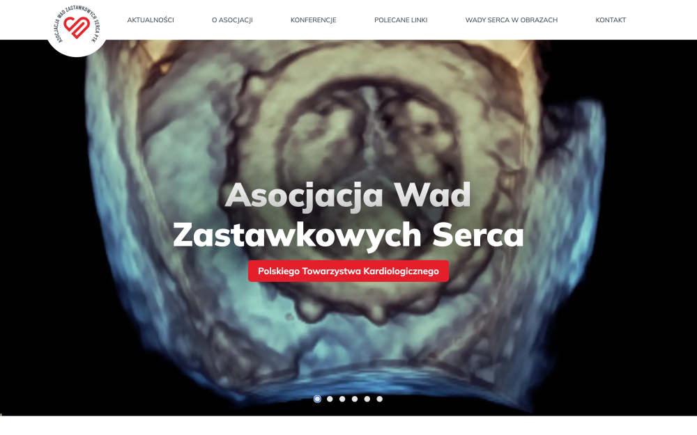 Nowa strona internetowa Asocjacji Wad Zastawkowych Polskiego Towarzystwa Kardiologicznego